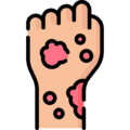 Dermatology